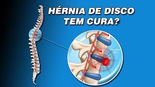 Hérnia de Disco tem Cura? - Ajustar Clinicas de Quiropraxia