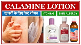 CALAMINE LOTION, खुजली के लिए बेस्ट लोशन, ITCHING, SKIN ALLERGY, INSECT BITES, ECZEMA, SKIN LOTION