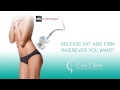 LPG by Endermologie Results -  Euro Charm Skincare  Body Clinic - Vancouver