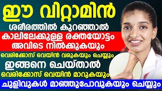 ഇങ്ങനെ ചെയ്താൽ വെരിക്കോസ് വെയിൻ മാറുകയും ചുളിവുകൾ മാഞ്ഞു പോവുകയും ചെയ്യും |vericose vein maran