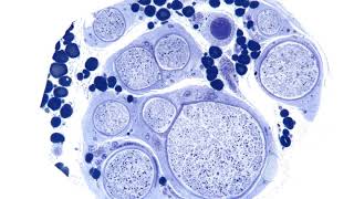 Neuropathology | Wikipedia audio article