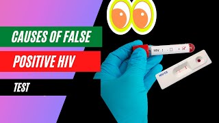 What causes false positive HIV test results?