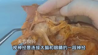 你知道你眼球后方是什么样子吗  视频中的就是真实的人眼后方结构