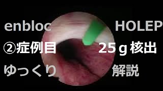 逆順行性en bloc HOLEP ゆっくり解説動画　②例目　核出25ｇ