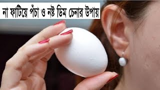 না ফাটিয়ে পঁচা ও নষ্ট ডিম চেনার উপায়, Shahin Bangla News