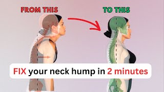 FIX neck hump with 2 minute exercise!