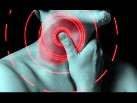 How to Recognize Throat Cancer Symptoms | Throat Cancer Information How to Recognize Throat Cancer Symptoms | Throat Cancer Information