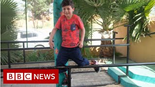 Syrian conflict: Helping children through the horror of bomb blasts - BBC News