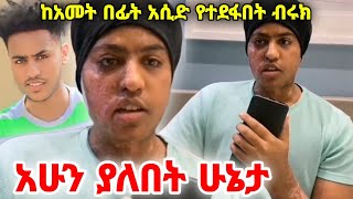 🔴ሳውዝ አፈሪካ ላይ አሲድ የተደፋበት ብሩክ አሁን ያለበት ሁኔታ. | Biruk Geremew