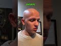 How bald people will go extinct #comedy #funny #alopecia #shortsmas