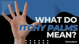 What Do Itchy Palms Mean? - Dermeleve®