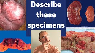 How to describe gross pathology specimens