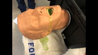 S.A.L.A.D. Intubation Demonstration