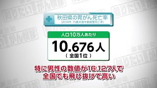 【知りたい！がん検診】Vol. 515回「胃がんに立ち向かうために」