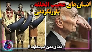 انسان های عجیب الخلقه و باورنکردنی با اعضای بدن غیر معمول که باورتان نمیشود وجود دارند ❗