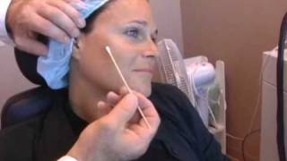 Intense Pulse Light - Photorejuvenation - Tampa / Clearwater - Ultimate Image