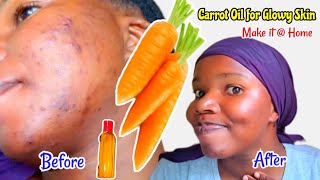 CARROT OIL:  For clear Skin \u0026 Hair Growth: How l Cleared my 12 years Acne/pimples, Hyperpigmentation