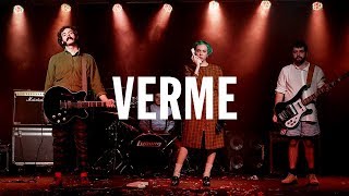 GOMMA - VERME