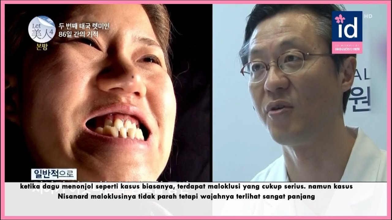 Review Operasi Plastik Saya Idhospital Indonesia Youtube