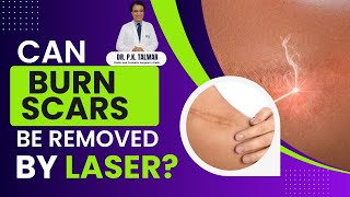 Can Burn Scars be Removed by Laser? Best Cosmetic Surgeon in Delhi | Dr. PK Talwar