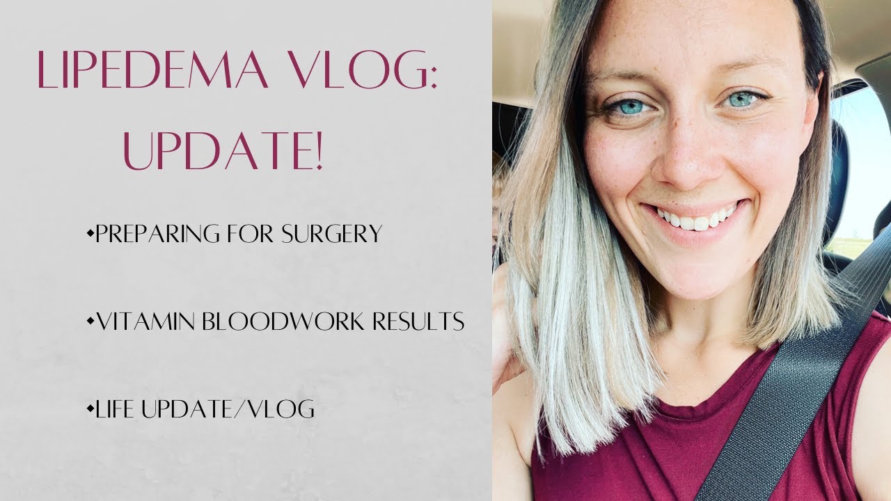 Lipedema Life Update Vlog Youtube