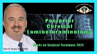 Hands On Surgical Techniques Course: Posterior Cervical Laminoforaminotomy - Dr. Neill M. Wright