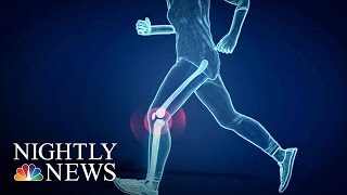 New Study Questions Effectiveness Of Knee Replacement Surgery | NBC Nightly News