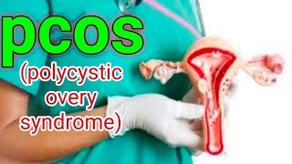 pcos(polycystic overy syndrome)-sign & symptoms:-#short