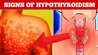 11 Signs That You Have Low Thyroid Level |Hypothyroidism Symptoms