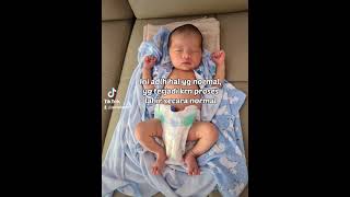 Bentuk kepala bayi saat lahir tidak rata / peyang