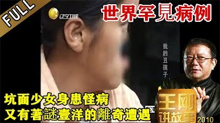 王剛講故事 第六十八期：我的醜孩子：坑面少女身患怪病，身世離奇，養母收養，惹來接二連三的家庭變故