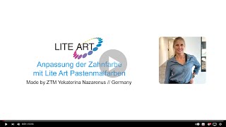 Anpassung der Zahnfarbe mit Lite Art Pastenmalfarben - Step by Step