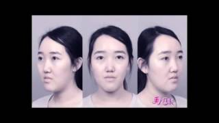 中国整形节目美人归来与韩国ID整形医院