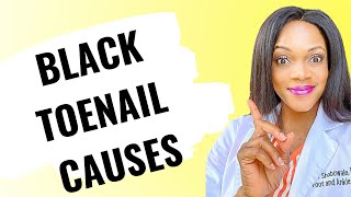 black toenail causes/causes of black toenail