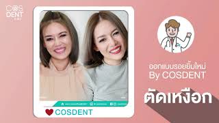 ตัดเหงือก เหงือกเยอะ แก้ได้ โดยอาจารย์หมอ ที่ COSDENT SMILE DESIGN