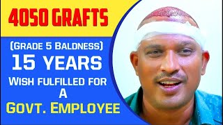 Hair Transplant in Vizag | Hair Clinic in Vizag |