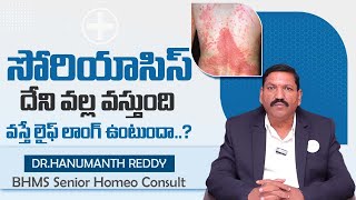 సోరియాసిస్ దేని వల్ల వస్తుంది..? | Dr.Hanumanth Reddy About Psoriasis | Best Treatment For Psoriasis