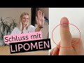 Schluss mit Lipomen bzw. Fettgeschwulsten | Derma-Quick-Tipp | Entfernung | OP | Lipolyse