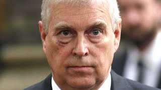 Prince Andrew's Complete Transformation
