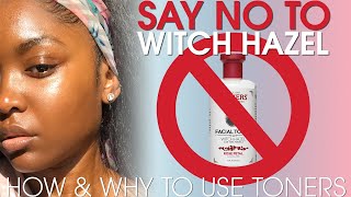 Please Stop Using Witch Hazel The Proper Way To Tone