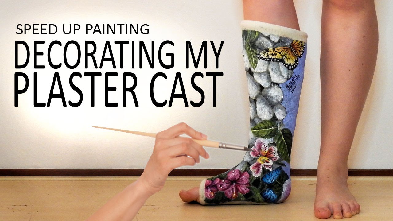 Painting My Plaster Cast 2 Butterflies On Leg Time Lapse Art