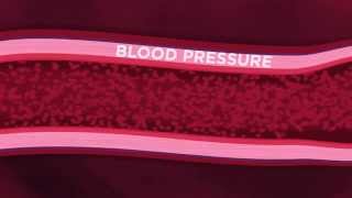 Blood pressure: what is blood pressure?