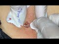 Satisfying video with Chung Vo Spa | 372