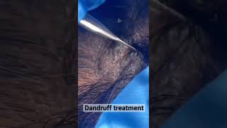 Dandruff treatment