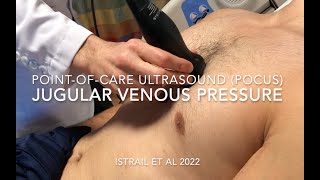 Jugular Venous Pressure (JVP) Exam using Point-of-care Ultrasound (POCUS)