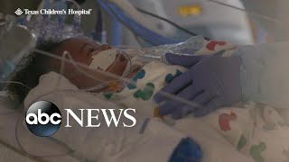 Pediatricians Call For Rsv Emergency Declaration