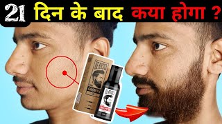 Beardo Hair Growth Oil After 21 Days Review | Best Beard Oil For Patchy Beard in India 2025 !