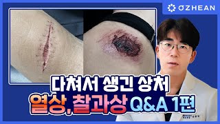 상처가 생겼을 때 꼭 병원을 가야할까?  [열상,찰과상Q\u0026A 1편]