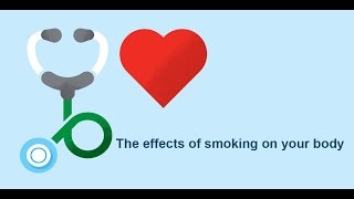 The effects of smoking on your body | Bupa Health