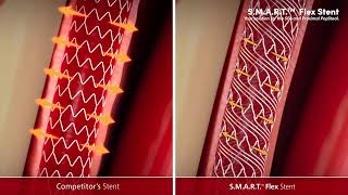 S.M.A.R.T.™ Flex Vascular Stent System, Fully Connected yet Highly Flexible